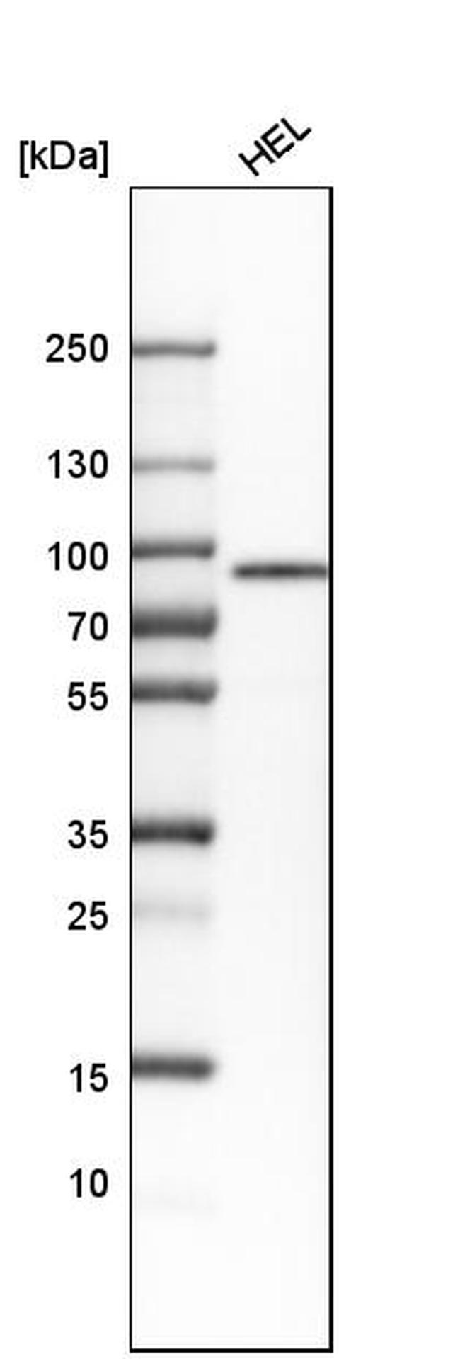 TXLNA Antibody in Western Blot (WB)