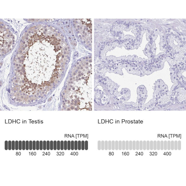 LDHC Antibody in Immunohistochemistry (IHC)