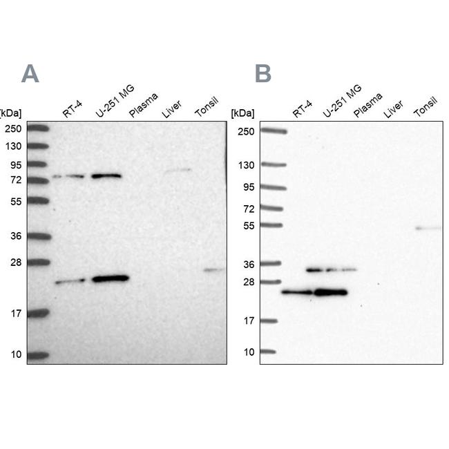 eIF3k Antibody in Western Blot (WB)