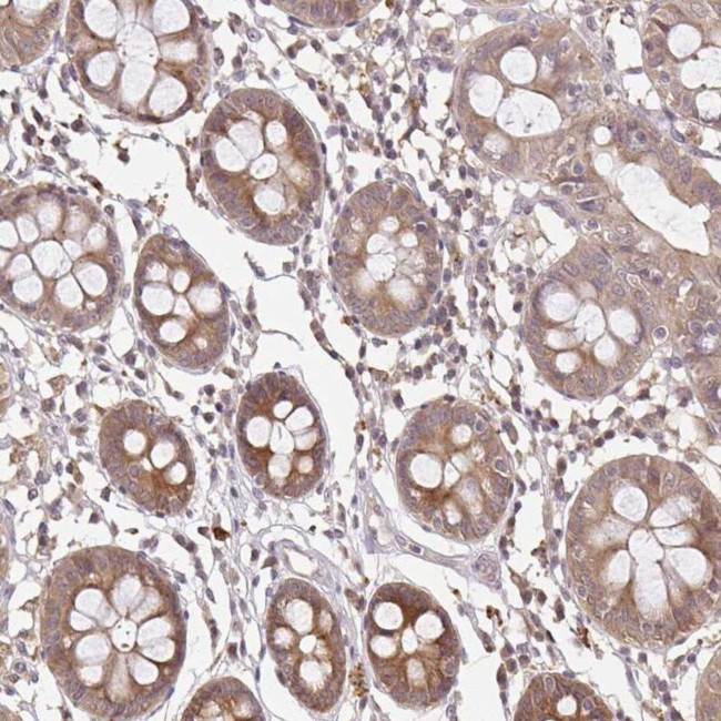 LARS2 Antibody in Immunohistochemistry (IHC)