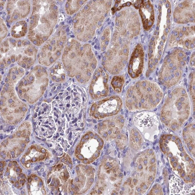 COX20 Antibody in Immunohistochemistry (IHC)