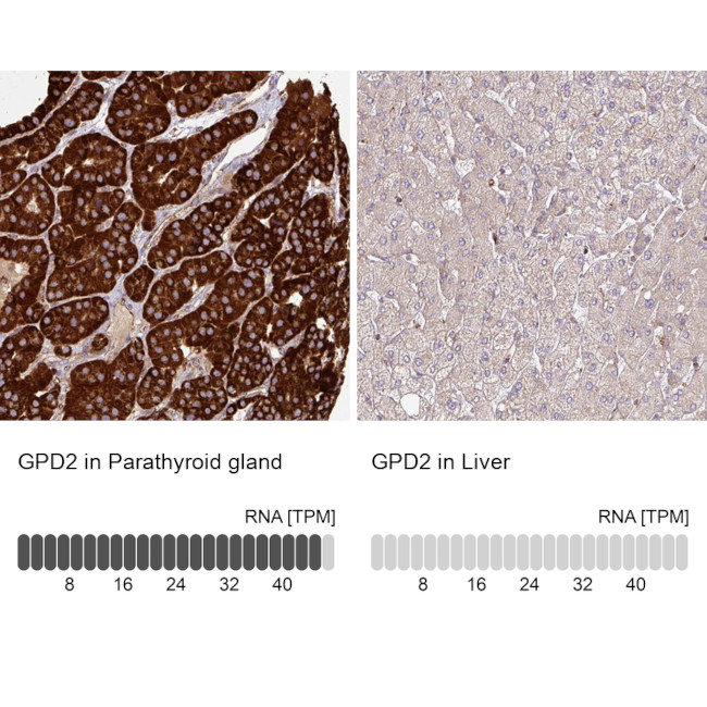 GPD2 Antibody in Immunohistochemistry (IHC)