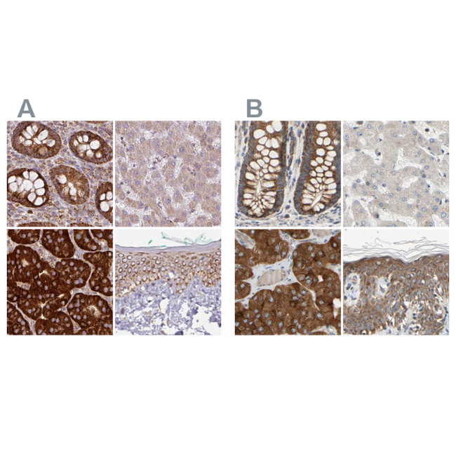 GPD2 Antibody in Immunohistochemistry (IHC)