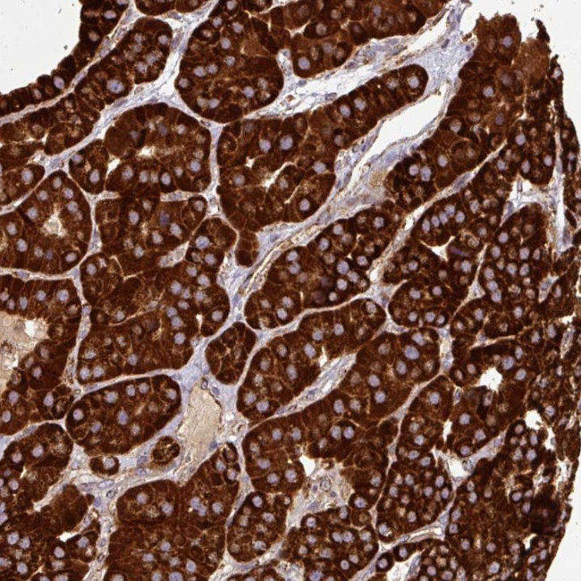 GPD2 Antibody in Immunohistochemistry (IHC)