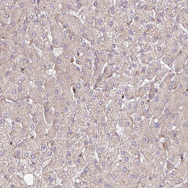 GPD2 Antibody in Immunohistochemistry (IHC)