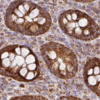 GPD2 Antibody in Immunohistochemistry (IHC)