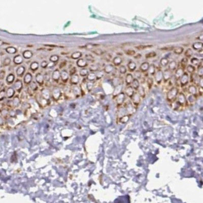 GPD2 Antibody in Immunohistochemistry (IHC)