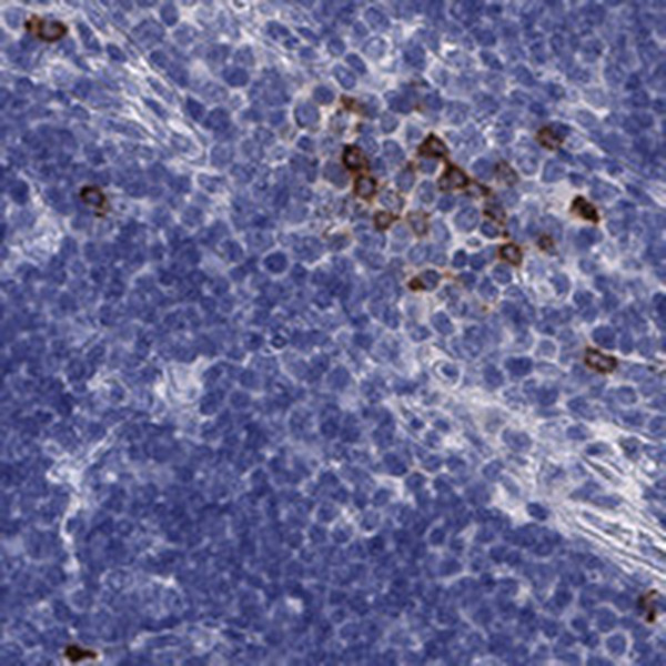 IL17REL Antibody in Immunohistochemistry (IHC)