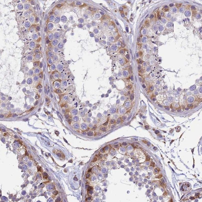 TCEAL5 Antibody in Immunohistochemistry (IHC)