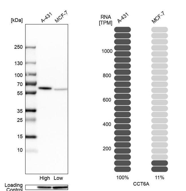 TCP-1 zeta Antibody in Western Blot (WB)