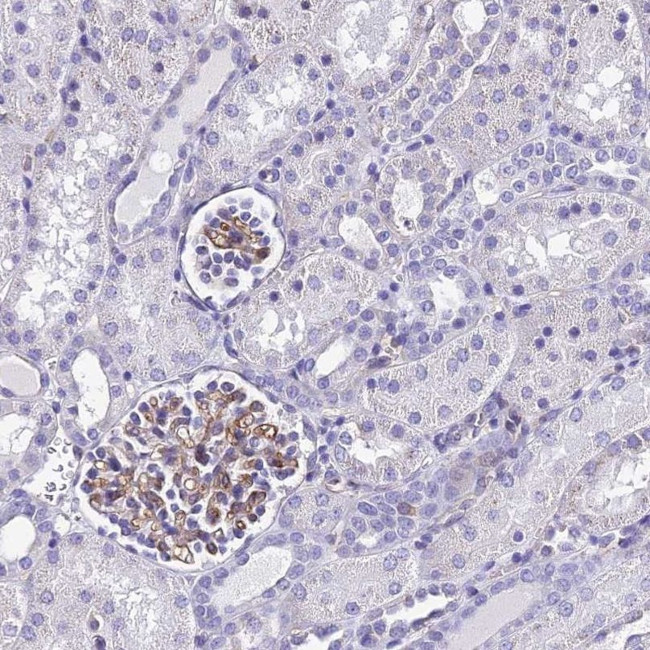 ADAMTSL2 Antibody in Immunohistochemistry (IHC)