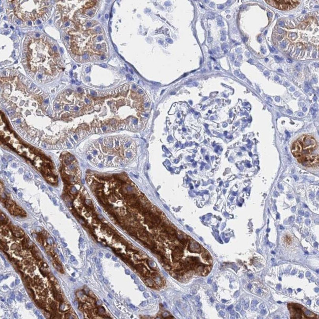 GGT1 Antibody in Immunohistochemistry (IHC)