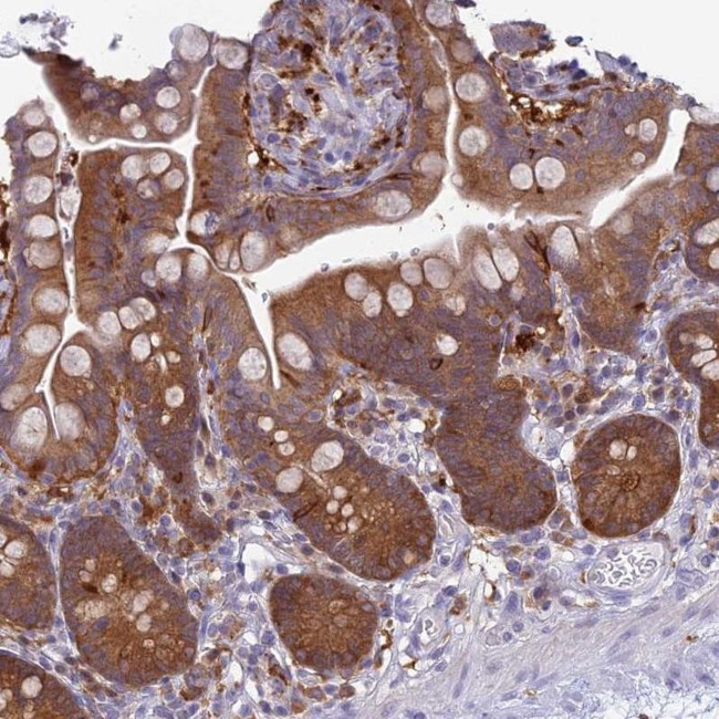 UBE2G1 Antibody in Immunohistochemistry (IHC)