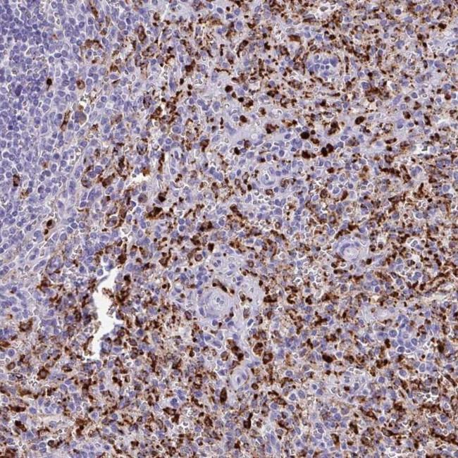 CPVL Antibody in Immunohistochemistry (IHC)