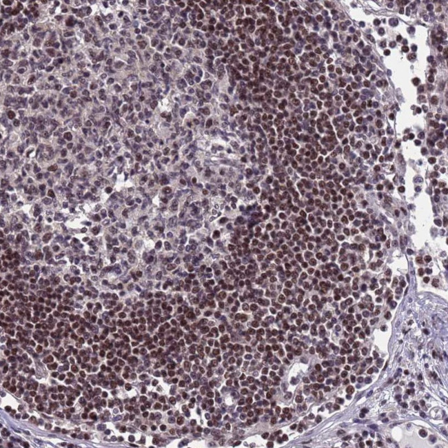 DC8 Antibody in Immunohistochemistry (IHC)