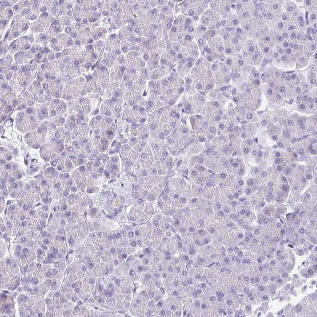 HAPLN2 Antibody in Immunohistochemistry (IHC)