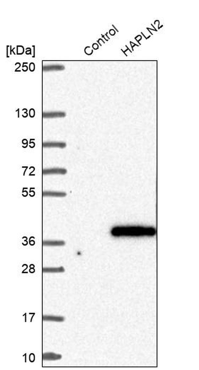 HAPLN2 Antibody in Western Blot (WB)