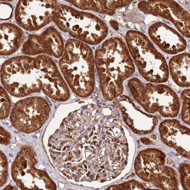 LYPLAL1 Antibody in Immunohistochemistry (IHC)