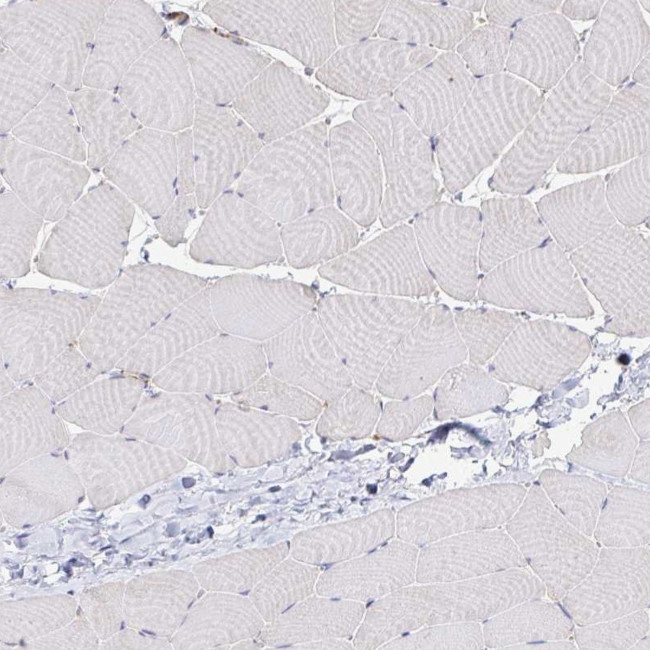 Desmoplakin Antibody in Immunohistochemistry (IHC)