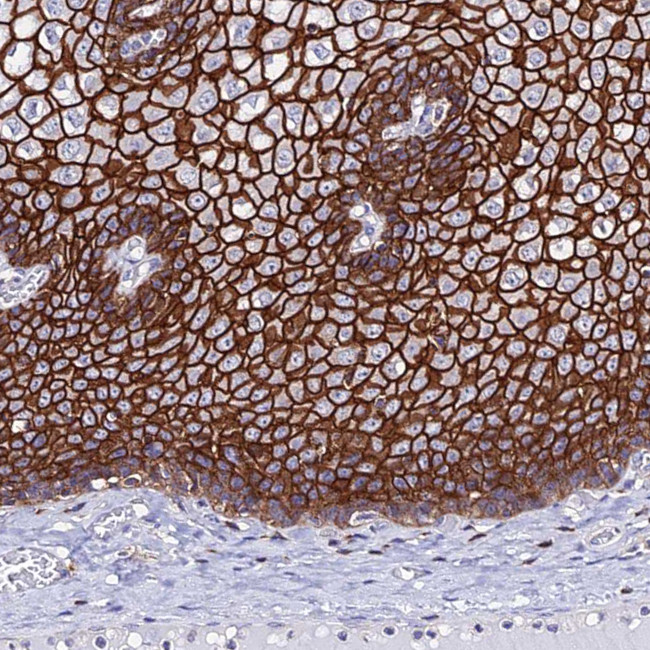 S100A16 Antibody in Immunohistochemistry (IHC)