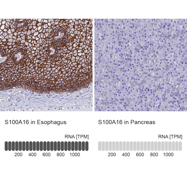 S100A16 Antibody