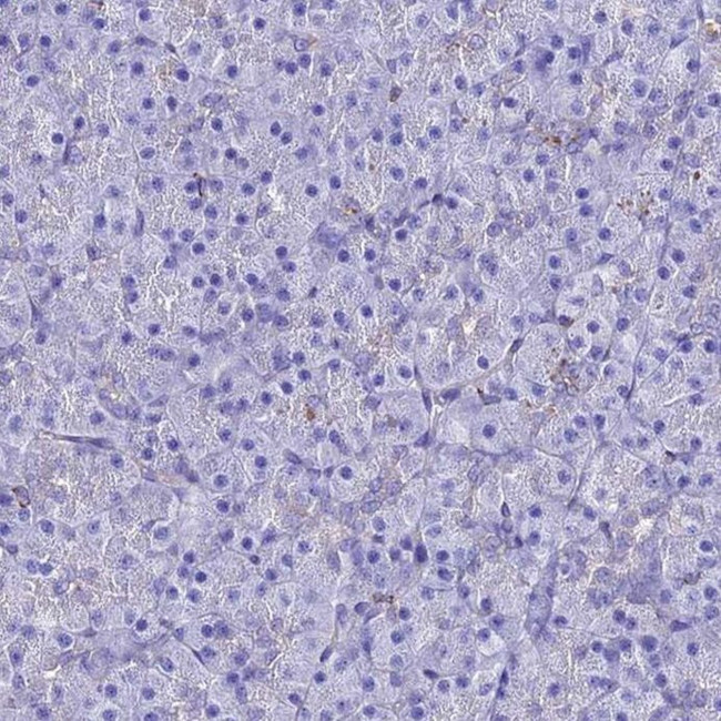 S100A16 Antibody in Immunohistochemistry (IHC)