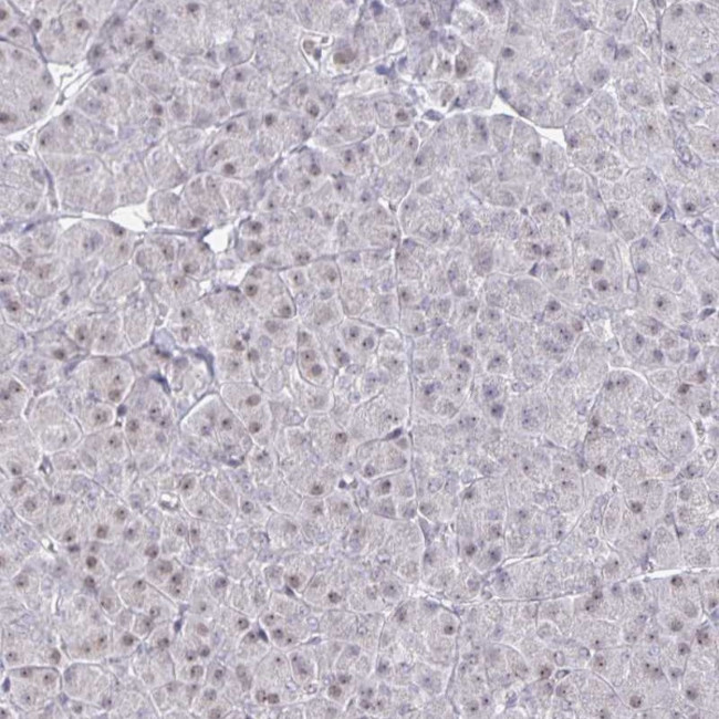 TRIP12 Antibody in Immunohistochemistry (IHC)