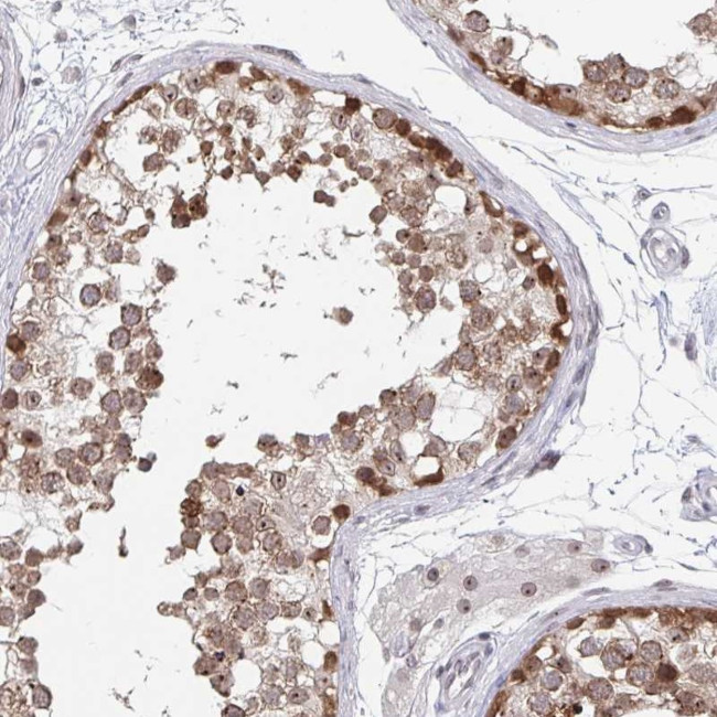 TRIP12 Antibody in Immunohistochemistry (IHC)