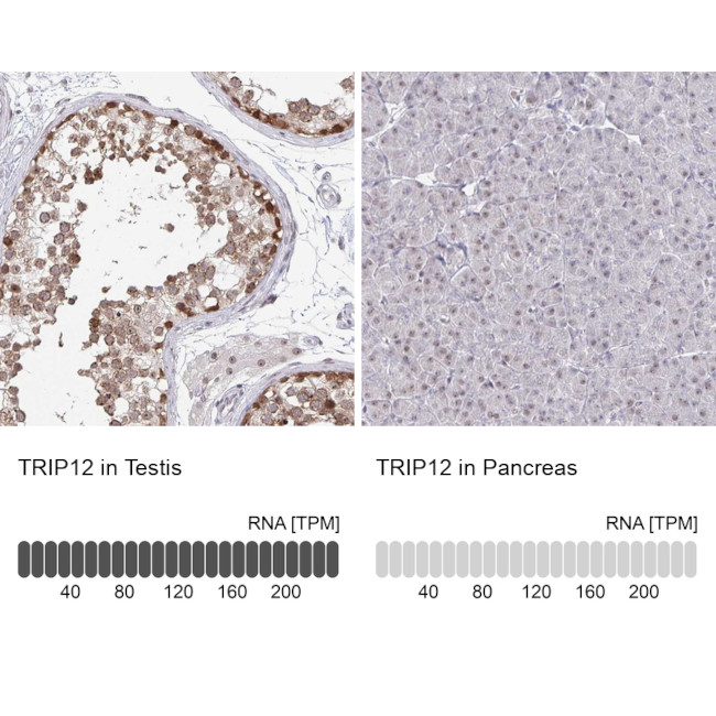 TRIP12 Antibody