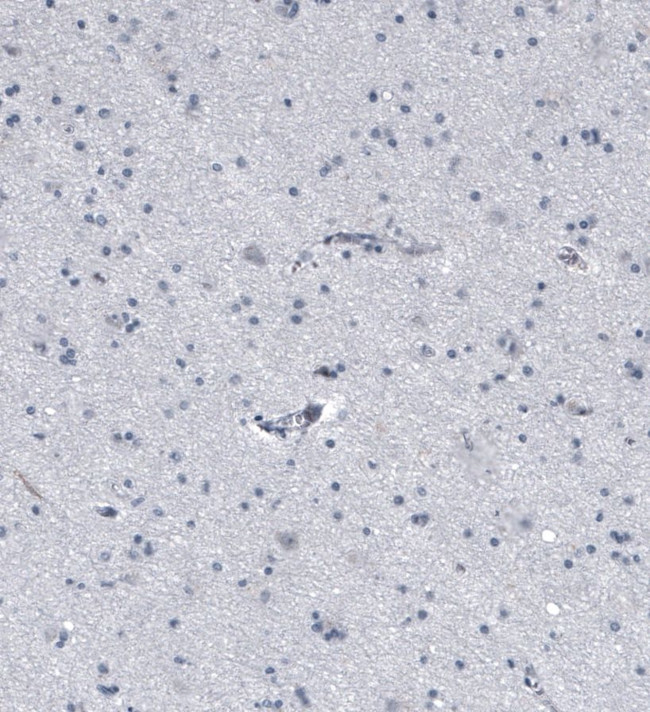 KRT77 Antibody in Immunohistochemistry (IHC)