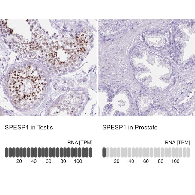 SPESP1 Antibody in Immunohistochemistry (IHC)