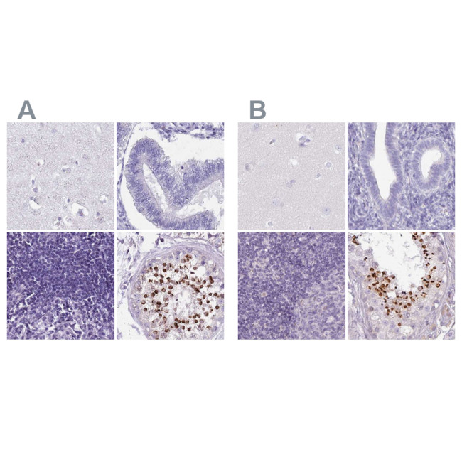 SPESP1 Antibody in Immunohistochemistry (IHC)