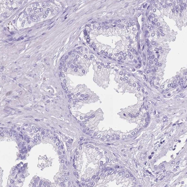 SPESP1 Antibody in Immunohistochemistry (IHC)