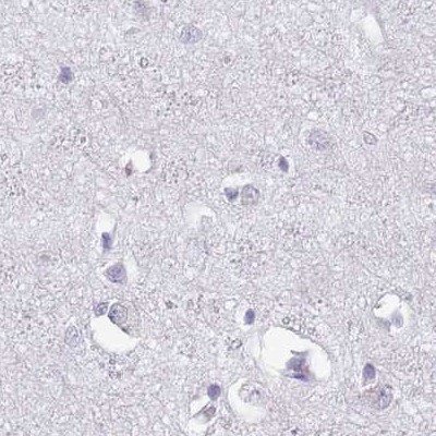 SPESP1 Antibody in Immunohistochemistry (IHC)