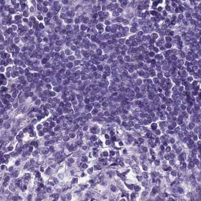 SPESP1 Antibody in Immunohistochemistry (IHC)