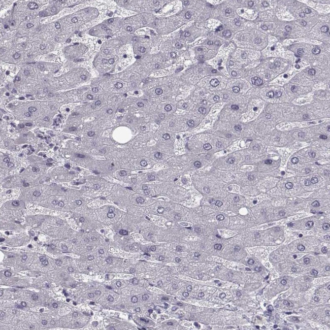 SLC28A2 Antibody in Immunohistochemistry (IHC)