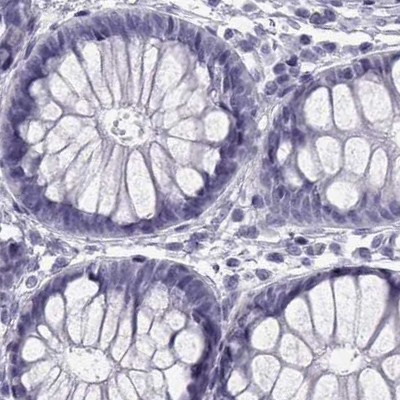 SLC28A2 Antibody in Immunohistochemistry (IHC)