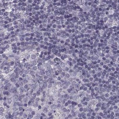 SLC28A2 Antibody in Immunohistochemistry (IHC)