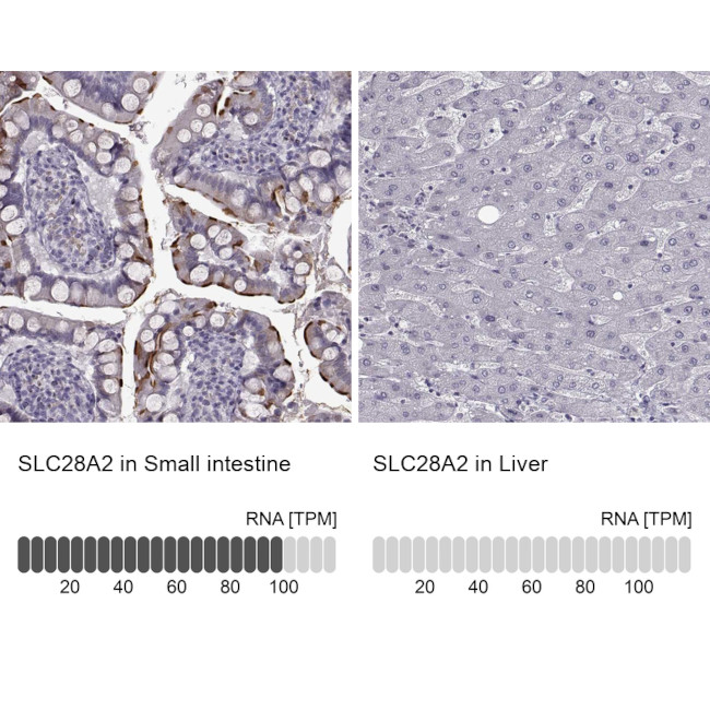 SLC28A2 Antibody