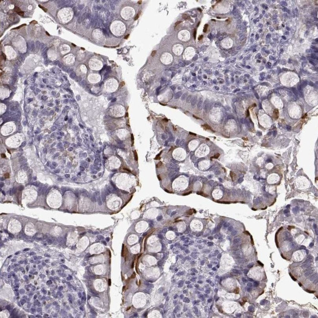 SLC28A2 Antibody in Immunohistochemistry (IHC)