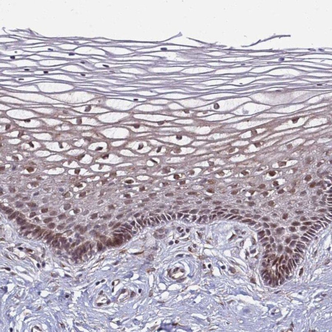 POLR2D Antibody in Immunohistochemistry (IHC)