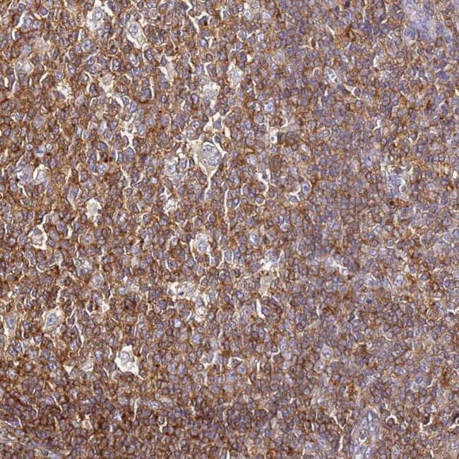 ZNF671 Antibody in Immunohistochemistry (IHC)