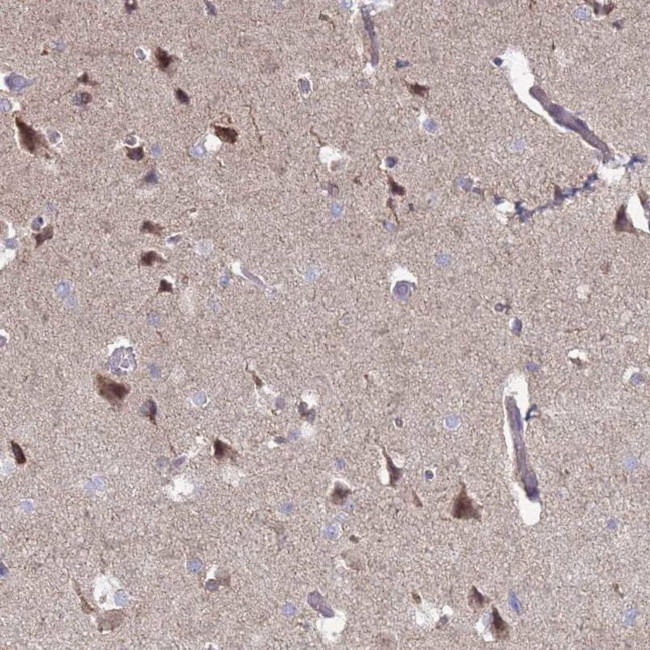 DIP2B Antibody in Immunohistochemistry (IHC)