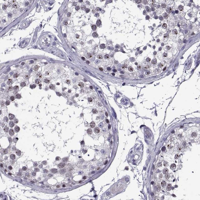 MAGEB18 Antibody in Immunohistochemistry (IHC)