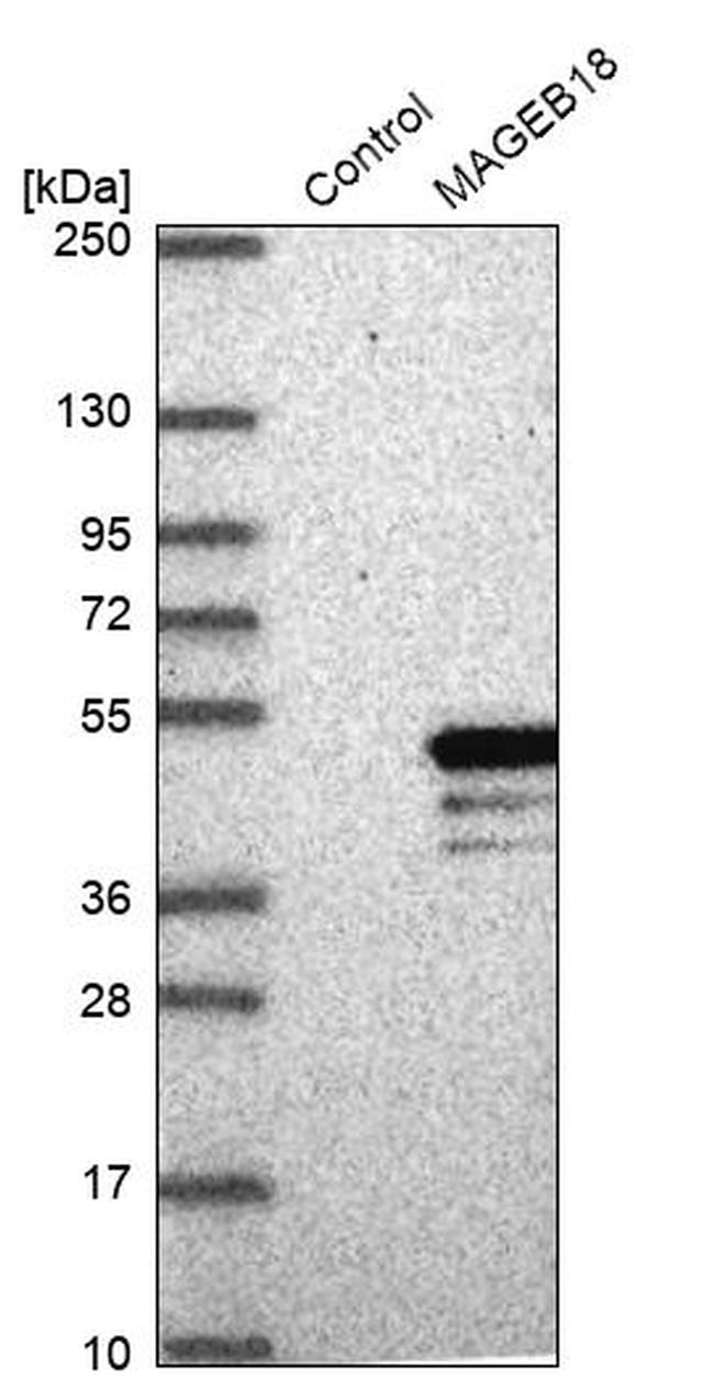 MAGEB18 Antibody in Western Blot (WB)