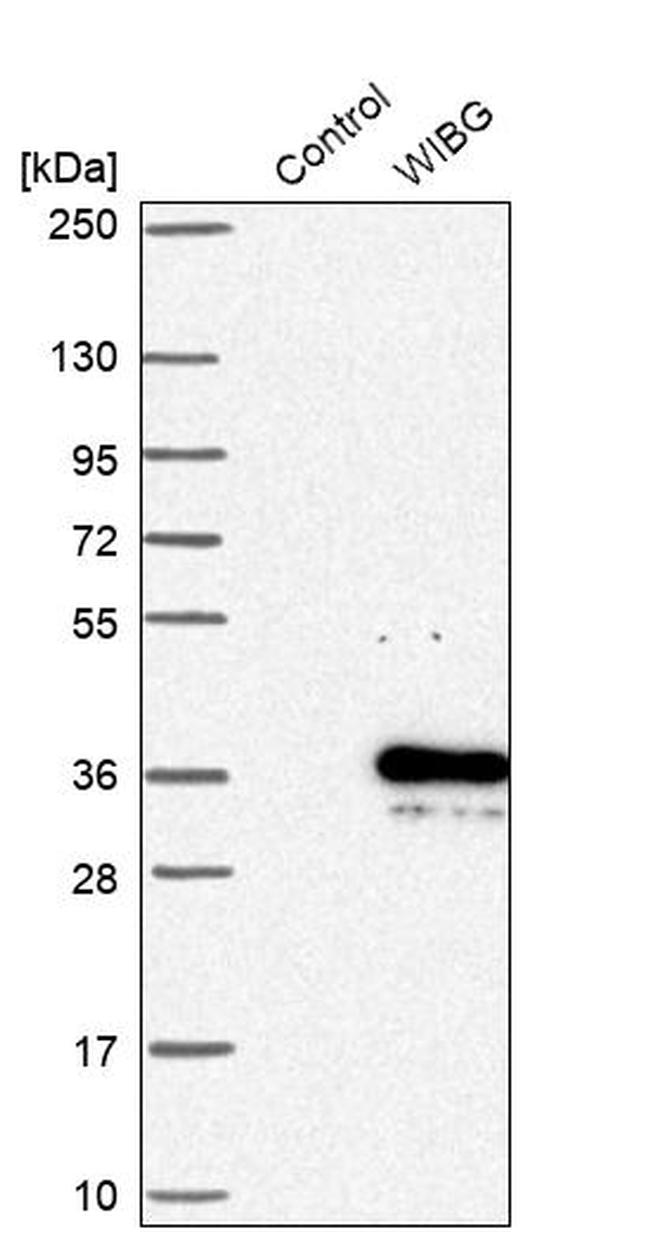 WIBG Antibody in Western Blot (WB)