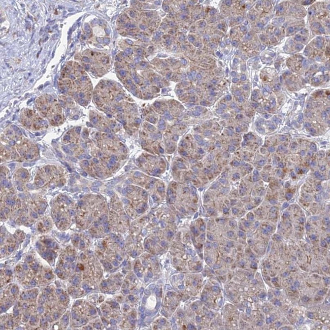 EFCAB4A Antibody in Immunohistochemistry (IHC)