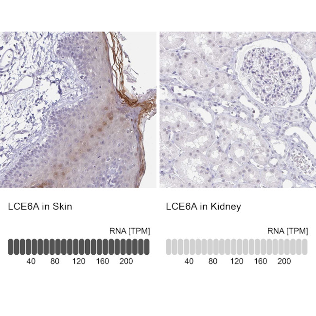 LCE6A Antibody in Immunohistochemistry (IHC)