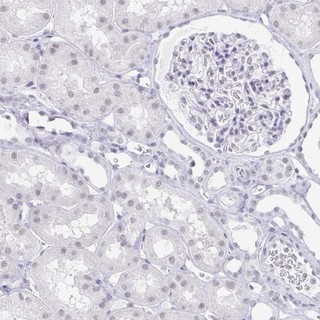 LCE6A Antibody in Immunohistochemistry (IHC)