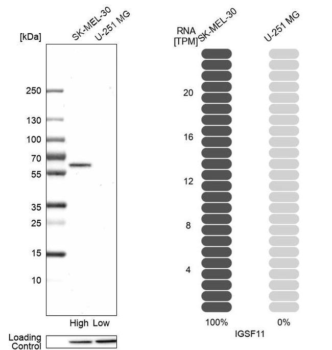 IGSF11 Antibody in Western Blot (WB)